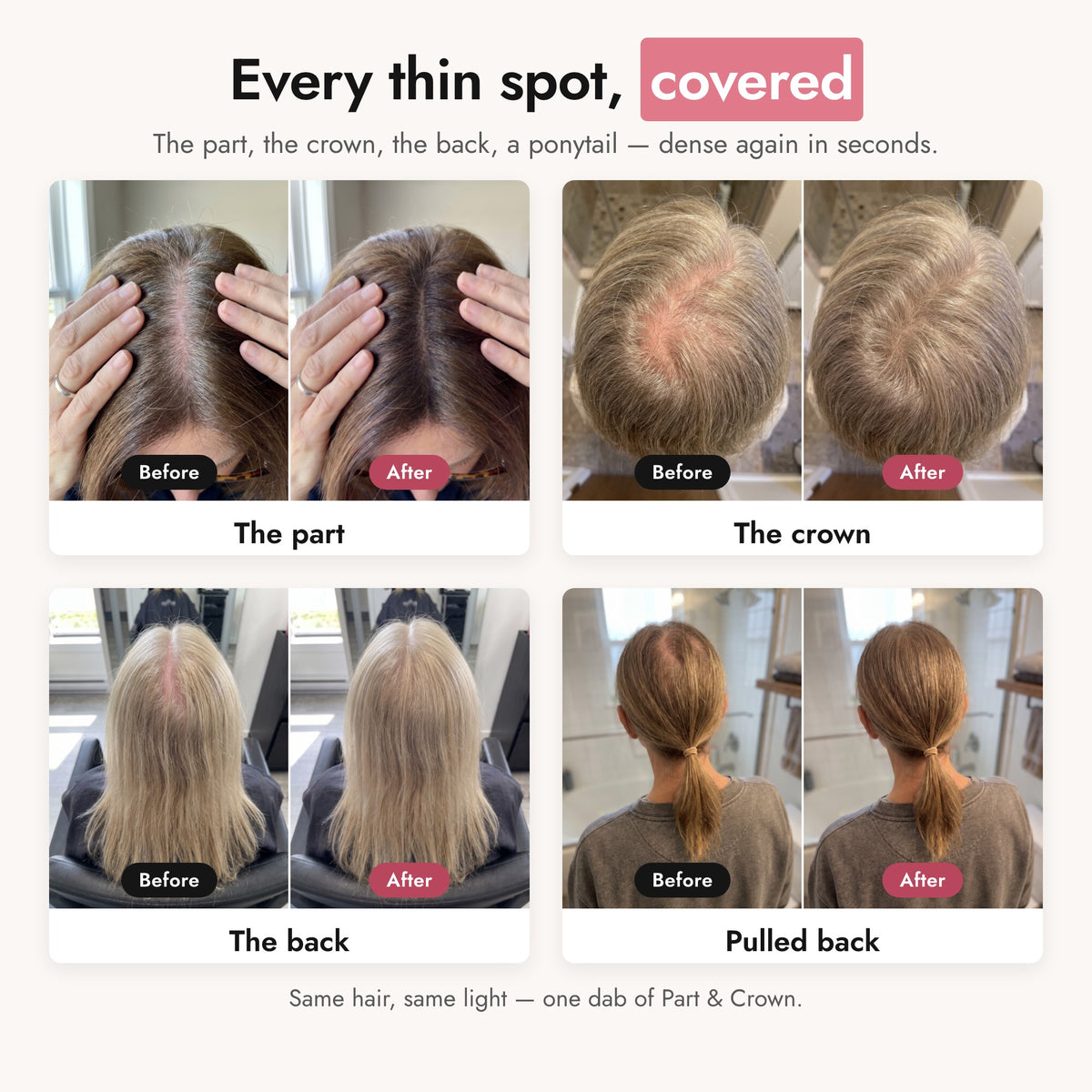 Before and after at the part, the crown, the back and with hair pulled back