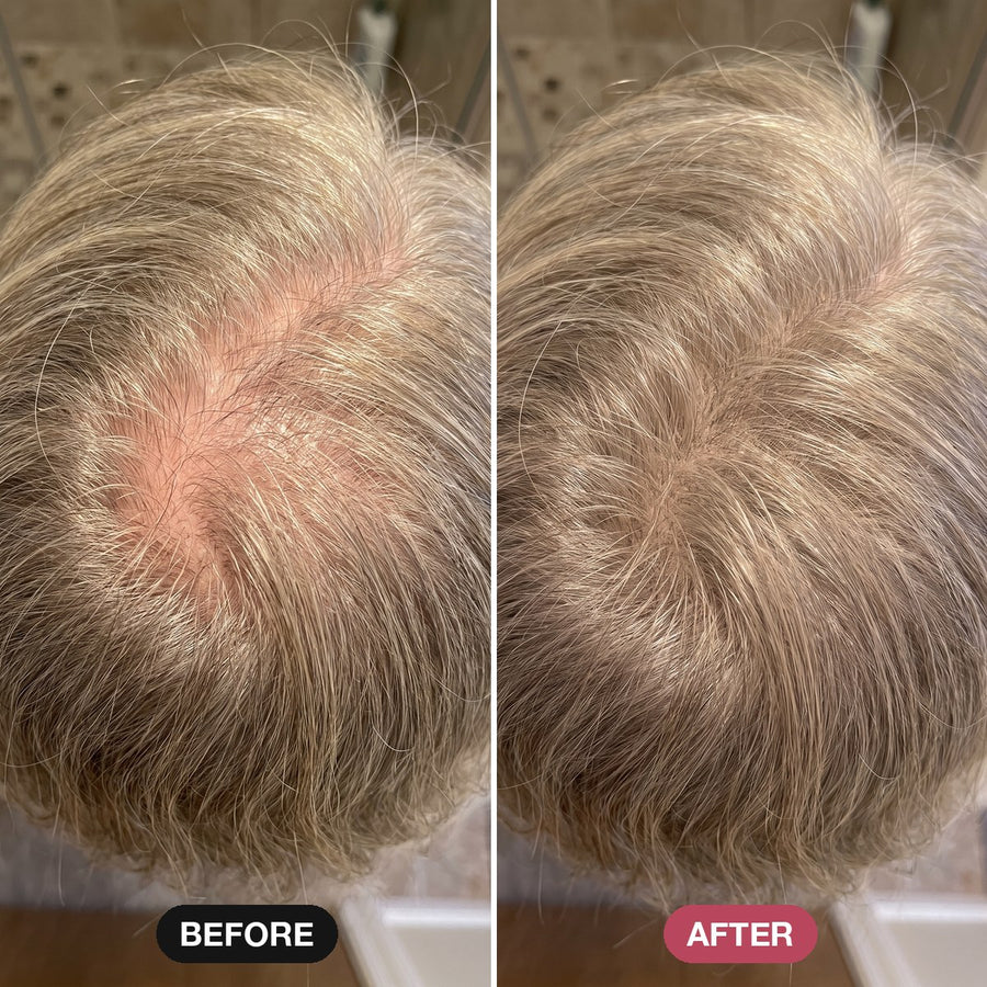Ash blonde, see-through crown