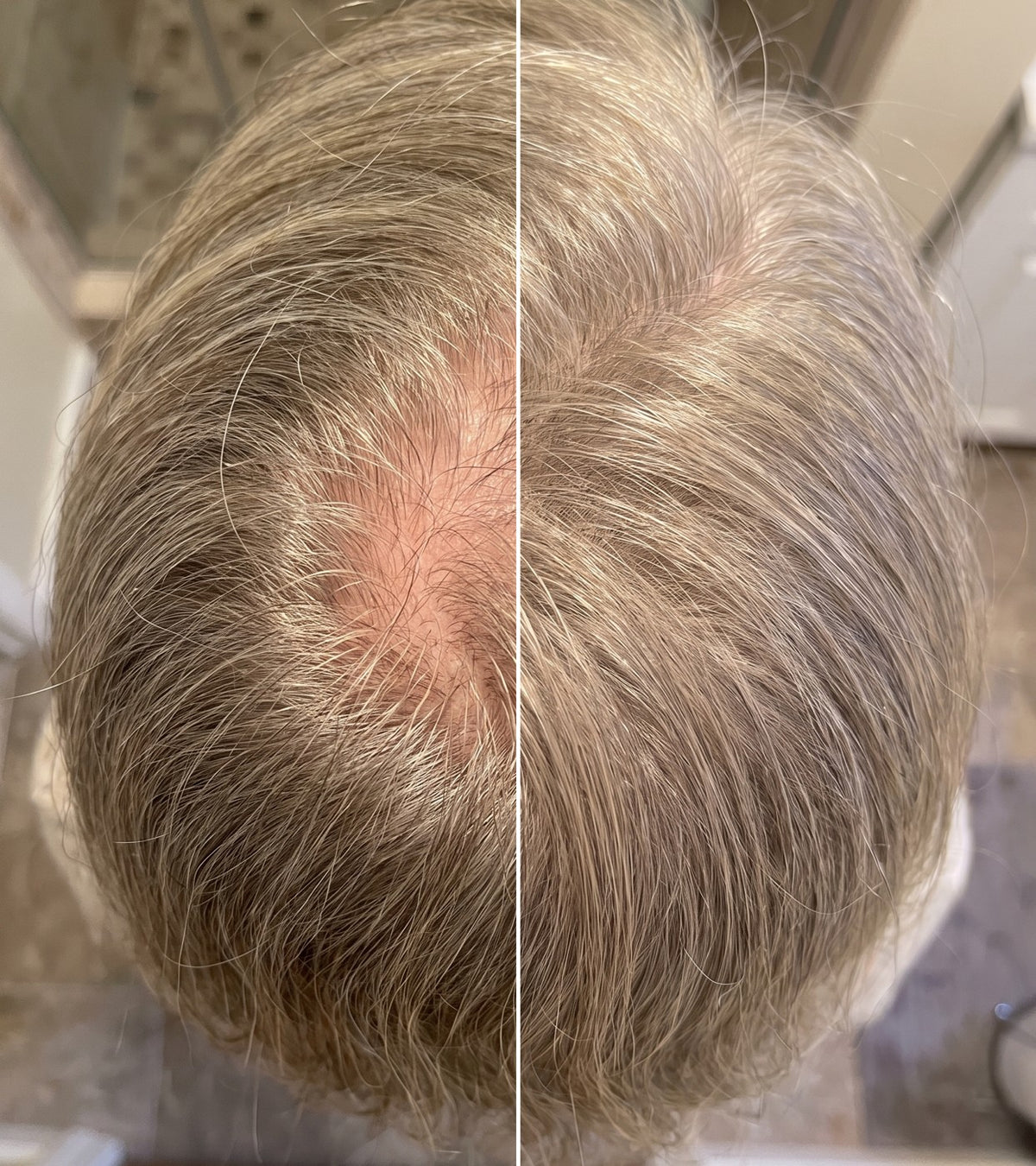Before and after at the crown: thin spot gone, same hair